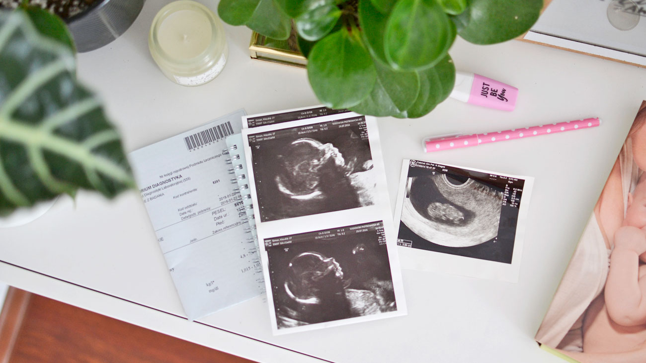 Badania w ciąży – jak się do nich przygotować?